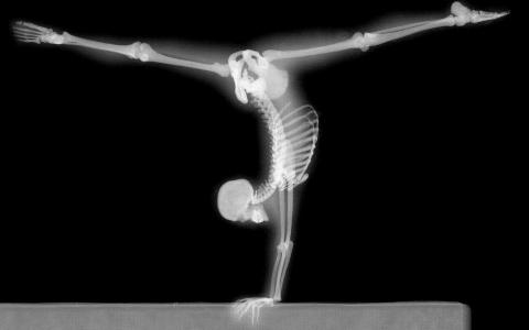体操运动员的X-射线